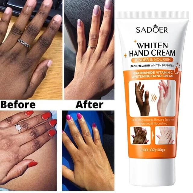 SADOER Whiten Dark Knuckles Hand Cream 100g