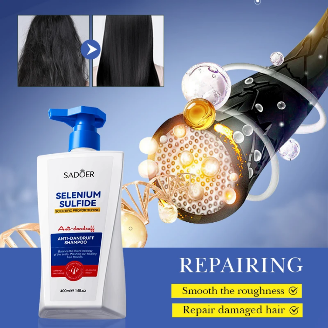 Sadoer Selenium Sulfide Anti-dandruff Shampoo 400ml