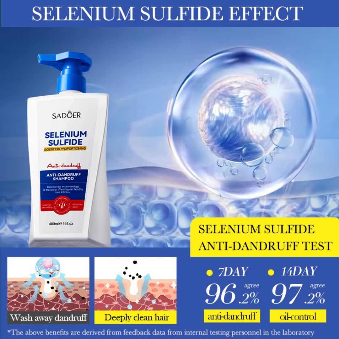 Sadoer Selenium Sulfide Anti-dandruff Shampoo 400ml