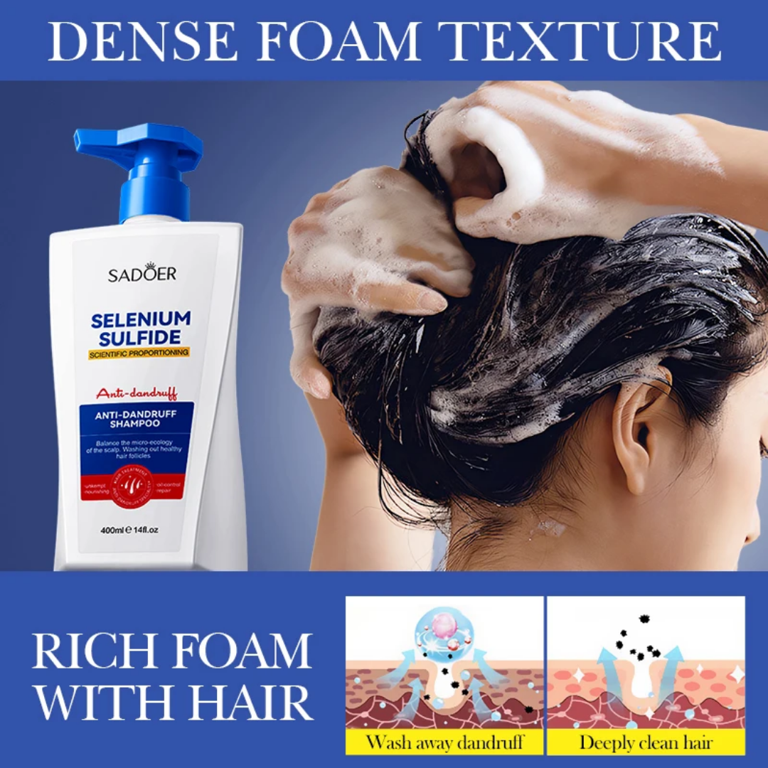 Sadoer Selenium Sulfide Anti-dandruff Shampoo 400ml
