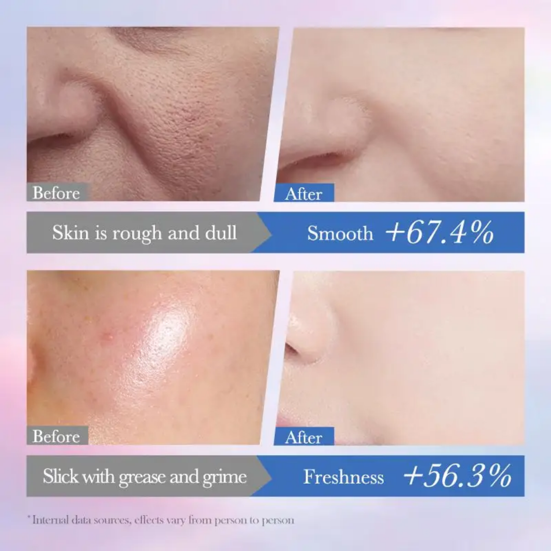 SADOER Whitening 10% Niacinamide spot Removal Gentle Cleanser 100g
