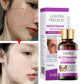 SADOER Lighten Freckles Nicotinamide Whitening Face Serum 30ml