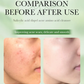 Sadoer Salicylc Acid 3%Amino Acid Gentle Face Cleanser 100g