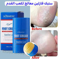 KORMESIC Repair Vaseline Care  Anti-wrinkle Foot stick Cream 30g