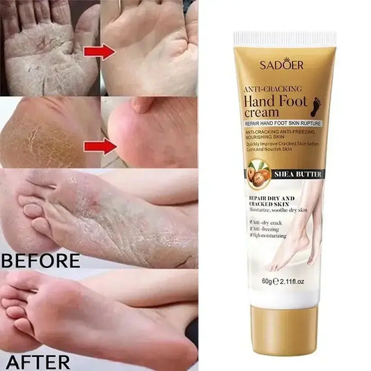 Sadoer Anti-Cracking Hand Foot Cream 60g