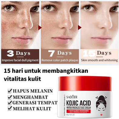 Sadoer  Kojic Acid Whiten Freckles Face Cream 30g