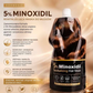 Kormesic 5% Minoxidil Revitalizing Hair Mask – Promotes Regrowth & Reduces Hair Loss